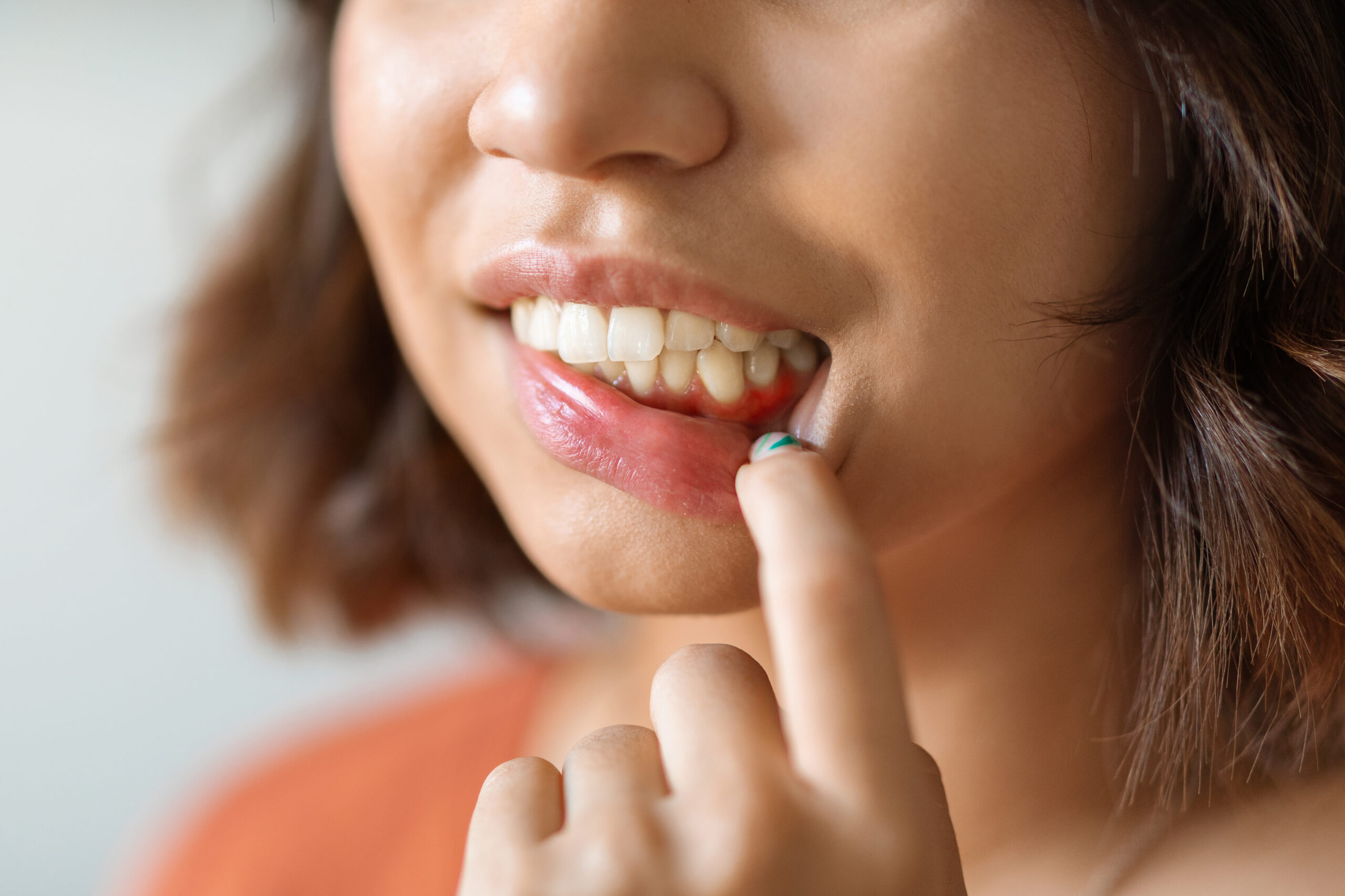 Gum Recession: Causes, Consequences, and Treatment